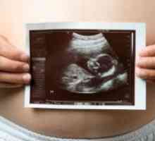 21 De săptămâni de sarcină - dimensiunea fetale