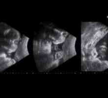 31 Săptămâni gravide - standarde de ultrasunete