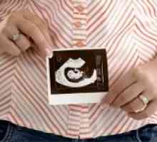 6 Săptămâni de gestație - dezvoltării fetale