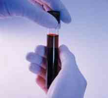 Un test de sange pentru sarcina