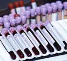 Sânge în oncologie
