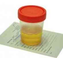 Analiza urinei - norma la copii