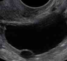 Anehogennoe formarea în ovar