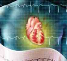 Aritmie cardiaca - tratament