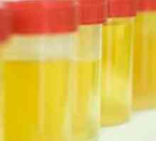 Bacteriile din urina din timpul sarcinii