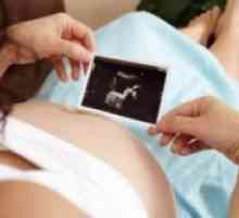Sarcina 26 săptămâni - dezvoltării fetale