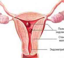 Sarcina și polip endometrial