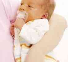 Bilirubina la nou-nascuti