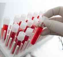 Biochimie sange - transcript