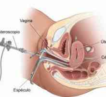 Biopsie endometriala