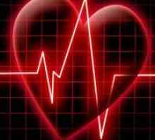 Aritmia sinusală periculoasă a inimii?