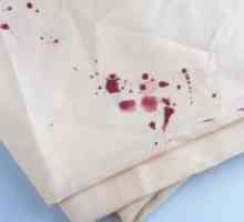 Cum să se spele sângele de pe hainele?