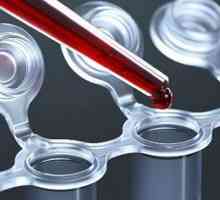 Ce face un test de sânge CEA?