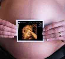 Ce este o ecografie 3D in timpul sarcinii