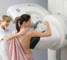 Mamografie digitala