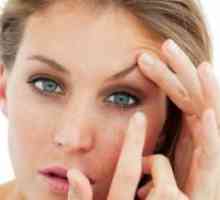 Acnee ochi - simptome și tratament
