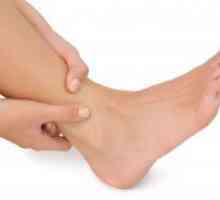 Dermatite pe picioare