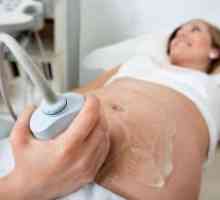 Ecografia Doppler în timpul sarcinii - ce este?