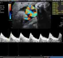 Doplerometrii în timpul sarcinii