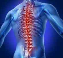 Hemangiom spinării - tratament