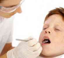 Sigilarea dinților la copii