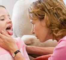 Herpes durere în gât la copii - Tratamentul