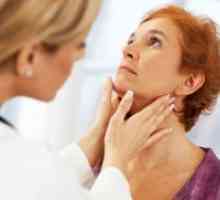 Hiperplazie tiroidiană