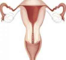 Hipoplazie uterin