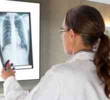 Cord pulmonar cronic