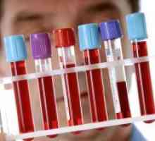 Test de sânge imunoenzimatică
