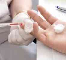 Test rapid pentru HIV