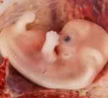 Embrion uman