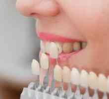 Restaurare estetică dentară