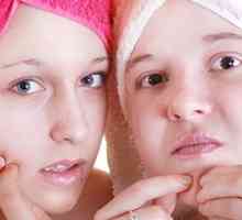 Cum să scapi de acnee adolescente