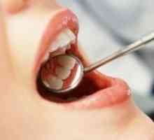Cum de a trata cariilor dentare?