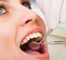Cum de a trata boala parodontala?