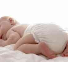Cum de a vindeca de căldură înțepător la nou-născuți?