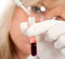 Cum de a determina tipul de sange?