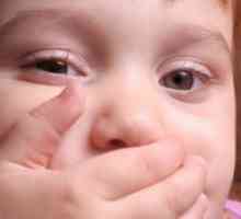 Cum este streptoderma copii?