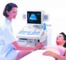 Cum este cu ultrasunete a ovarelor?