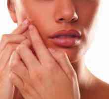 Cum de a elimina cicatrici de acnee?