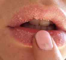 Cum de a vindeca buzele crapate?
