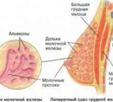 Carcinomul mamar