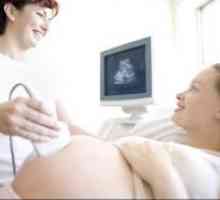Când face ecografie în timpul sarcinii?