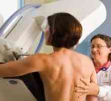 Când este cel mai bine pentru a face o mamografie?