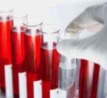 Când donează sânge pe HCG?