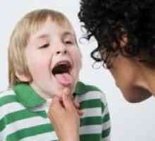 Frenul scurt a limbii copilului