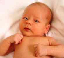 Torticolis, la un copil de 3 luni - Simptome