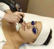 Laserul a demonstrat rezultate excelente în intinerirea pielii