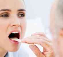 Tratamentul candidozei orale la adulți